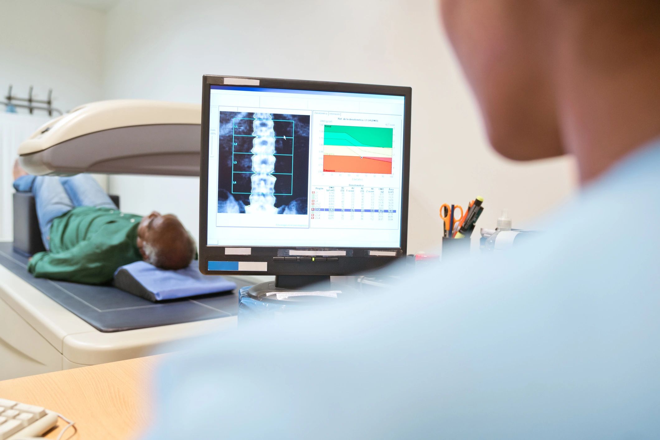 bone density scan