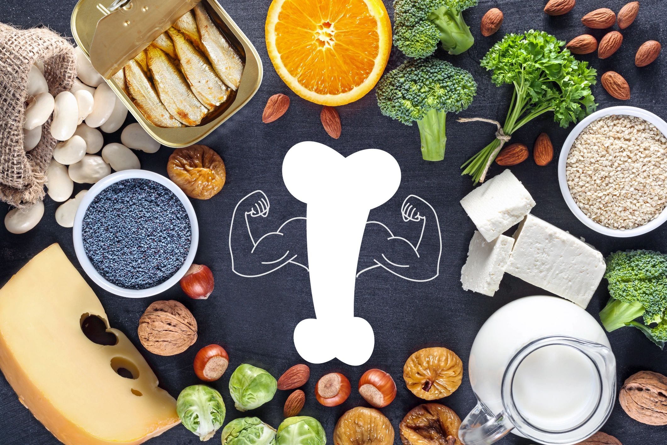 nutrition for bones